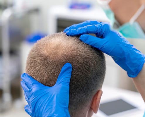 Les patients diabétiques peuvent-ils avoir une greffe de cheveux ? 14 Les patients diabétiques