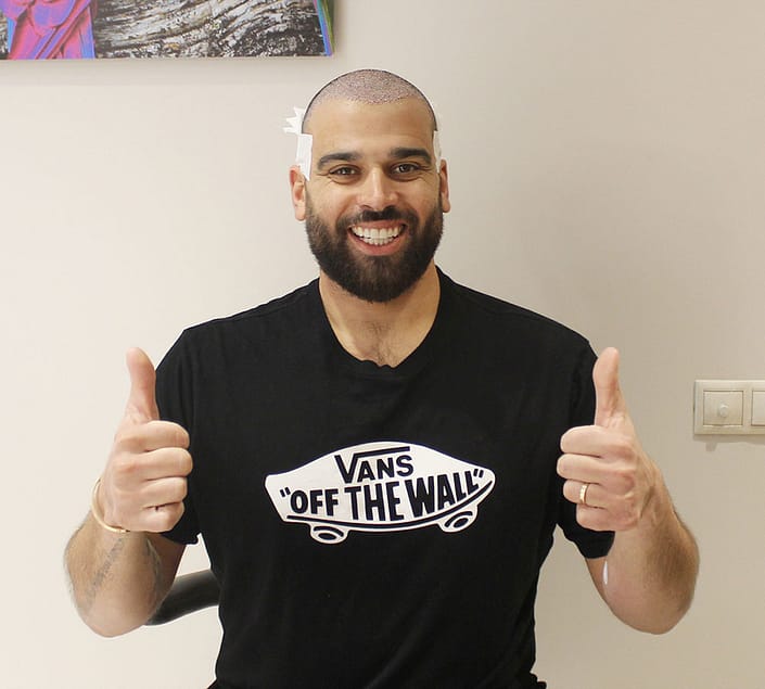 Nore Abdelali Hair Transplant Nore Abdelali Hair Transplant