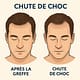 Chute de Choc après une Greffe de Cheveux 3 Chute de Choc après une Greffe de Cheveux
