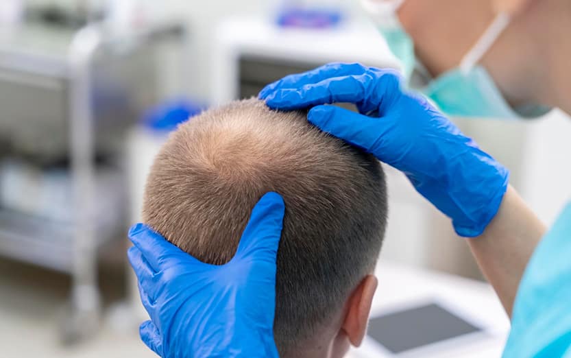 Les patients diabétiques peuvent-ils avoir une greffe de cheveux ? 21 Les patients diabétiques
